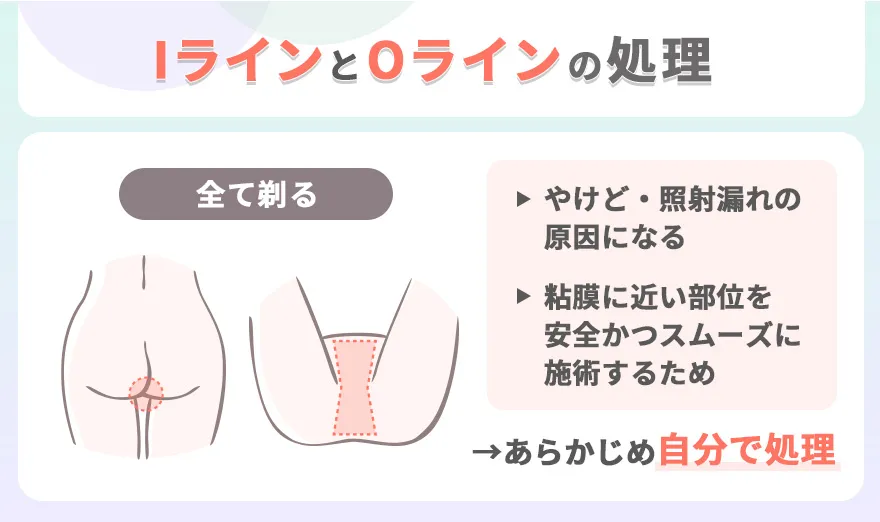 IラインとOラインの処理