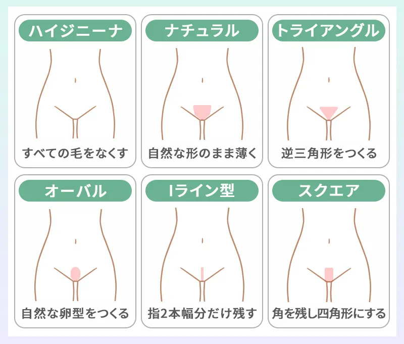 VIO脱毛の代表的なデザイン